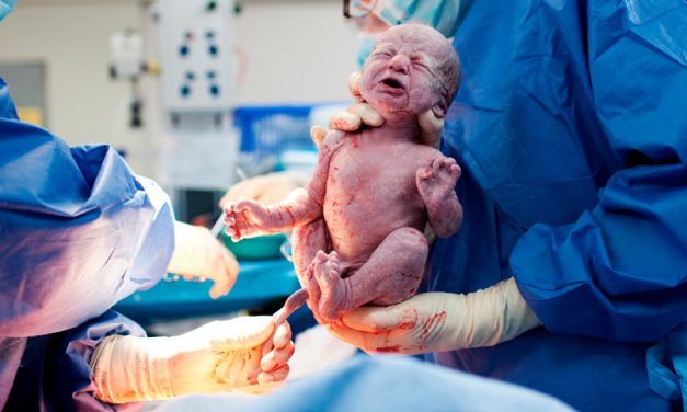 La cesárea afecta al cerebro del bebé